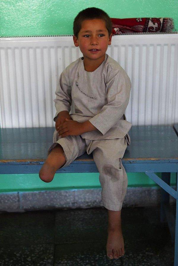Ahmed Rahman, henüz 8 aylıkken mayın patlamasıyla tek bacağını kaybetmişti.