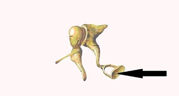 12. И последний вопрос. Как называется эта кость уха?