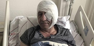 Gazeteci Demirağ'a Sopayla Saldıran 6 Kişi, 'Hayati Tehlike Bulunmadığı' Gerekçesiyle Serbest Bırakıldı