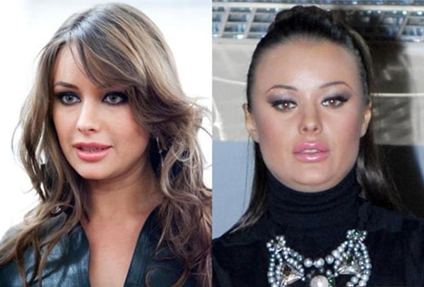 8. У бывшей мисс Вселенная Оксаны Федоровой лицо значительно округлилось