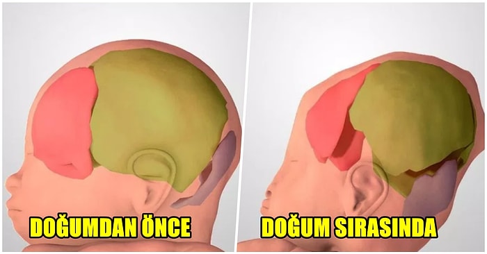 Doğumun Her Anı Mucize! Bebeklerin Kafa Yapılarının Geçirdiği İlginç Evreleri Gösteren 3D Fotoğraflar