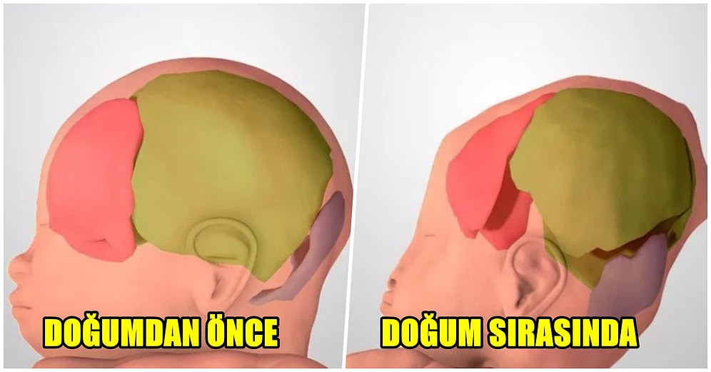 Doğumun Her Anı Mucize! Bebeklerin Kafa Yapılarının Geçirdiği İlginç Evreleri Gösteren 3D Fotoğraflar