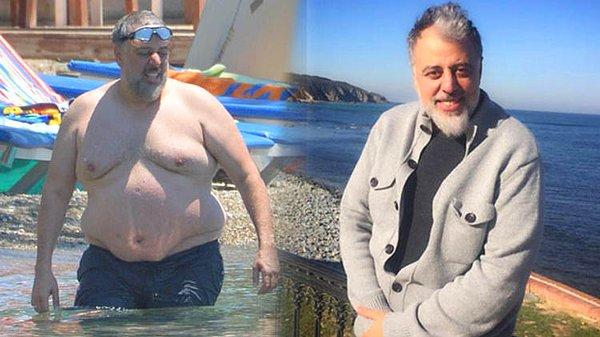 12. Yıllardır fazla kilolarından şikayetçi olan, zaman zaman diyet yaparak zayıflayan Hamdi Alkan, sonunda çareyi yağ aldırmakta buldu...