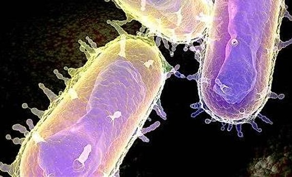 8. Чего не имеет клетка возбудителя чумы?