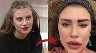 Kısmetse Olur'da Bir Zamanlar Fırtınalar Estiren Melis Buse Betkayan'ın Son Hali Görenleri Hayrete Düşürdü!