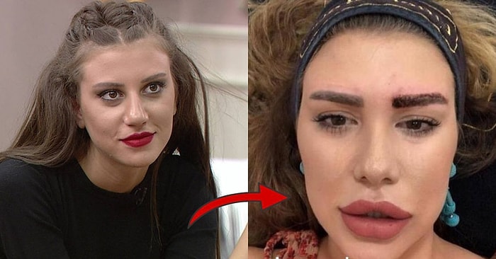 Kısmetse Olur'da Bir Zamanlar Fırtınalar Estiren Melis Buse Betkayan'ın Son Hali Görenleri Hayrete Düşürdü!