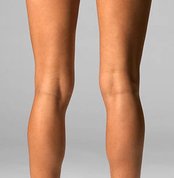 12. Ни в одном языке мира нет названия для обратной части колена