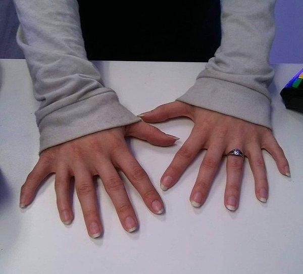 “Bir müşteri her birinde 6 parmağı olan ellerinin fotoğrafını çekmeme izin verdi.”