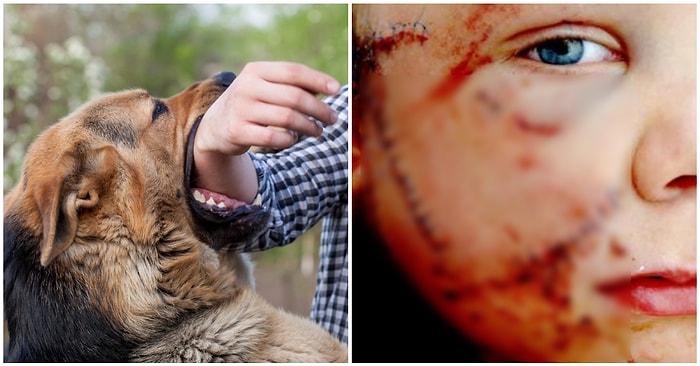 Bilim İnsanları Açıklıyor: Küçük Çocuklu Aileler, Isırılma Riskine Karşı Evde Köpek Beslerken Ne Yapmalı?