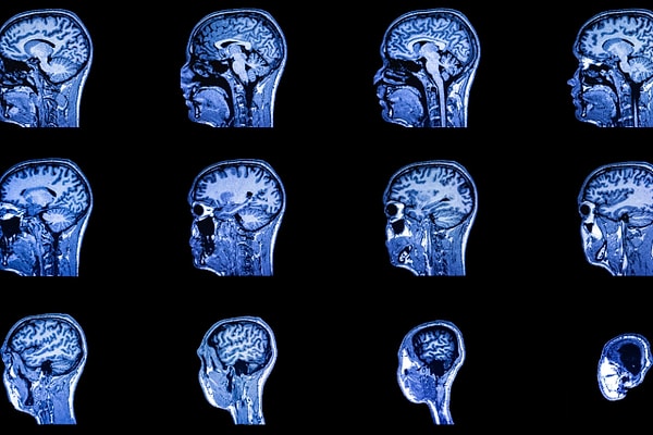 1. Черная немочь, которую мы сейчас знаем как эпилепсию. Чем лечить?