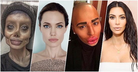 Hayranı Oldukları Ünlülere Benzeyebilmek İçin Bir Ameliyattan Diğerine Koşup Adeta Tanınmaz Hale Gelen 18 Kişi