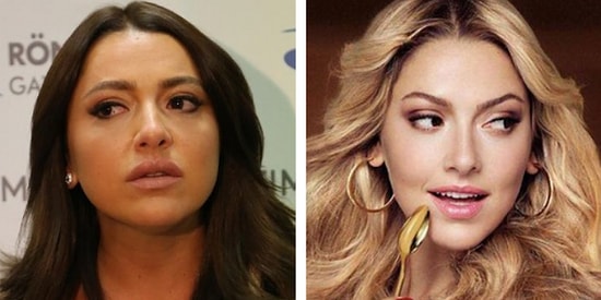 Zayıfladım Yalanına İnanmayın! Yüz Hatlarını Yeniden Yaratan Jawline Çene Dolgusunu Yaptırmış Ünlüler