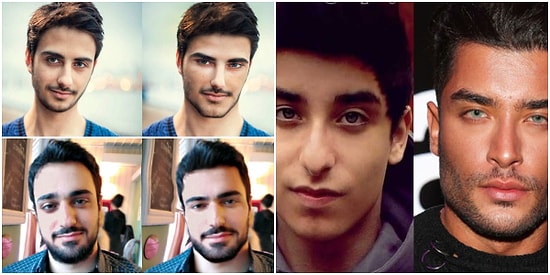 Güzel Bir Kadınla Birlikte Olma İhtimali Olmadığını Düşünen ve İçine Kapanan Erkekler Çareyi Plastik Cerrahide Arıyor