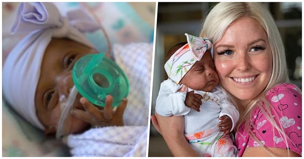 Dünyanın En Küçük Bebeği Saybie Hayata Tutunma Mücadelesini Kazandı ve Hastaneden Taburcu Oldu
