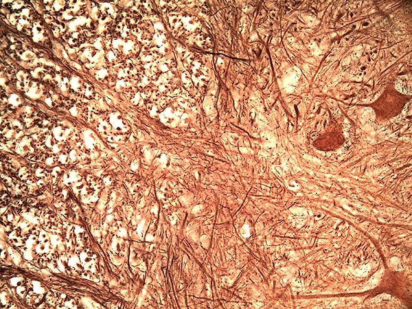 10. А вот здесь будет посложнее
