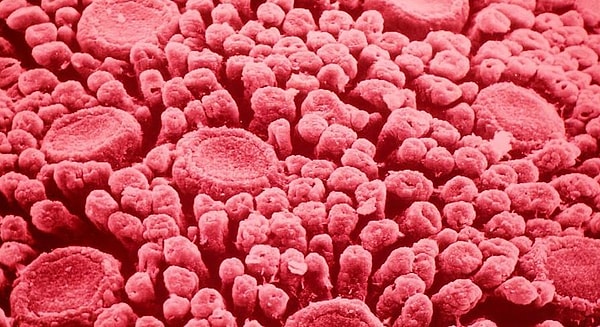 3. Ну тут вы точно не ошибетесь