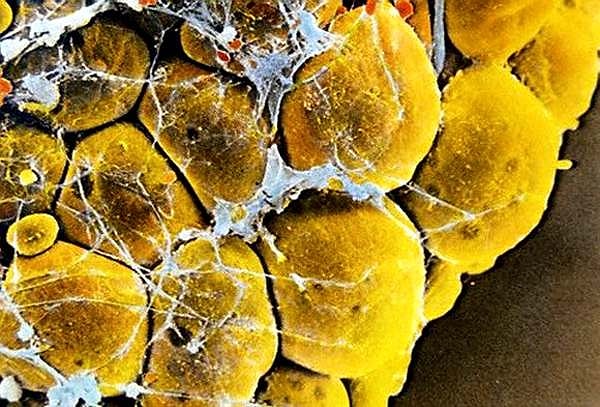 11. Тут догадаться не сложно