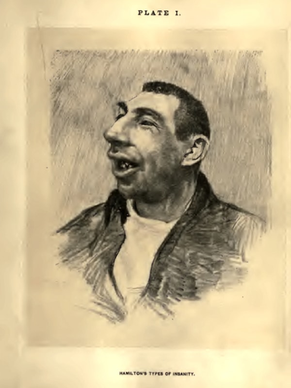 5. Как по-медицински называется самая тяжелая степень умственной отсталости?