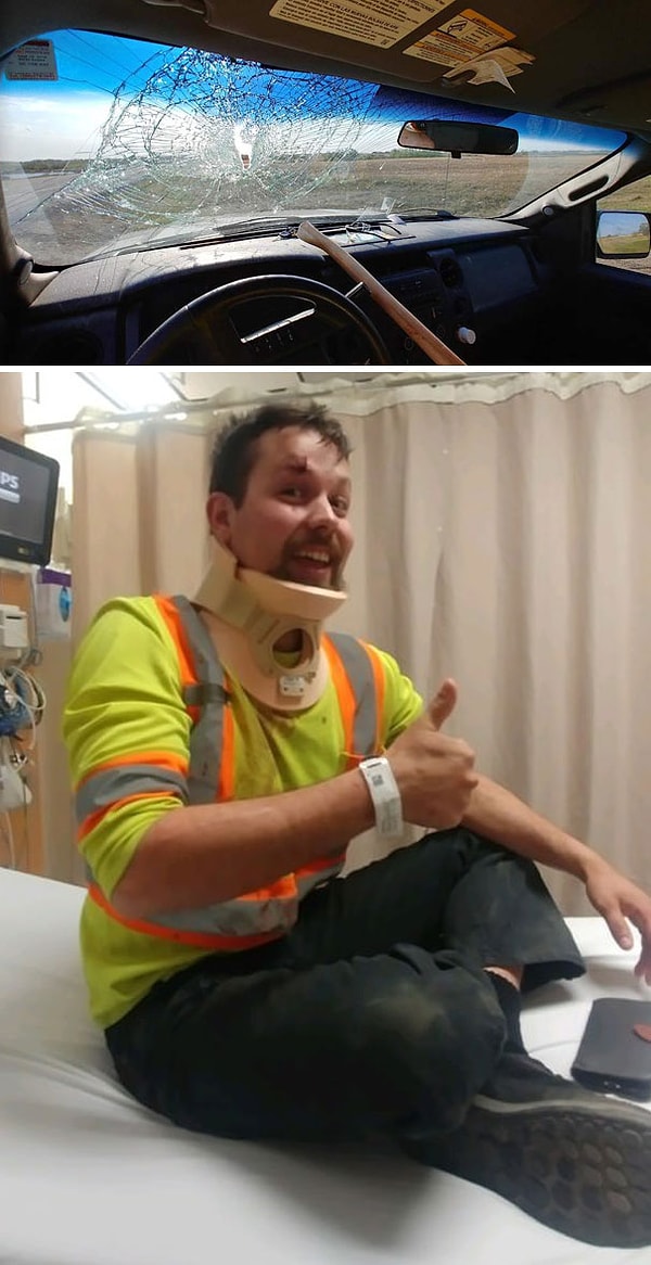 26. В лобовое стекло этого парня врезался топор, пока он вел машину. Чудо, что он остался жив