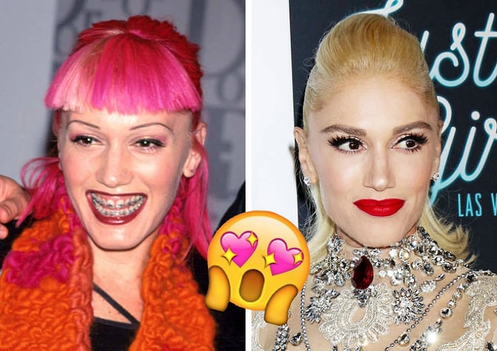 15 западных знаменитостей, которые с возрастом стали только краше