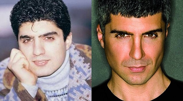 1. Özcan Deniz'in burnundaki ve elmacık kemiklerindeki değişimi fark etmemek mümkün değil sanki?