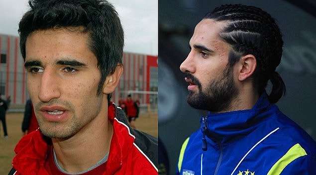 11. Futbolcu Alper Potuk da burun ameliyatı yaptıranlardan.