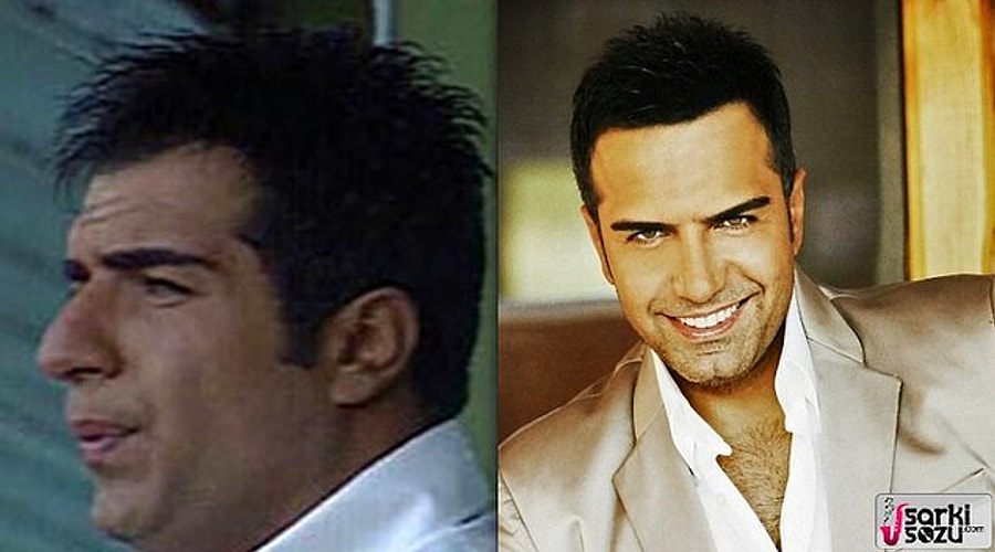 Serdar Ozturk Estetik