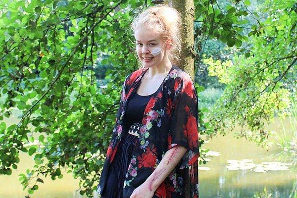 Anoreksiya nedeniyle tedavi gören Noa Pothoven, haziran ayından bu yana beslenmeyi reddederek pasif ötanaziyi seçti.