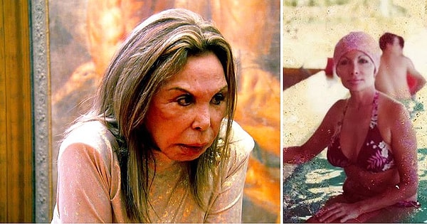 4. Эльза Паттон