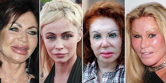 Из красавиц в дурнушек: Именитые женщины, которых изуродовала пластика