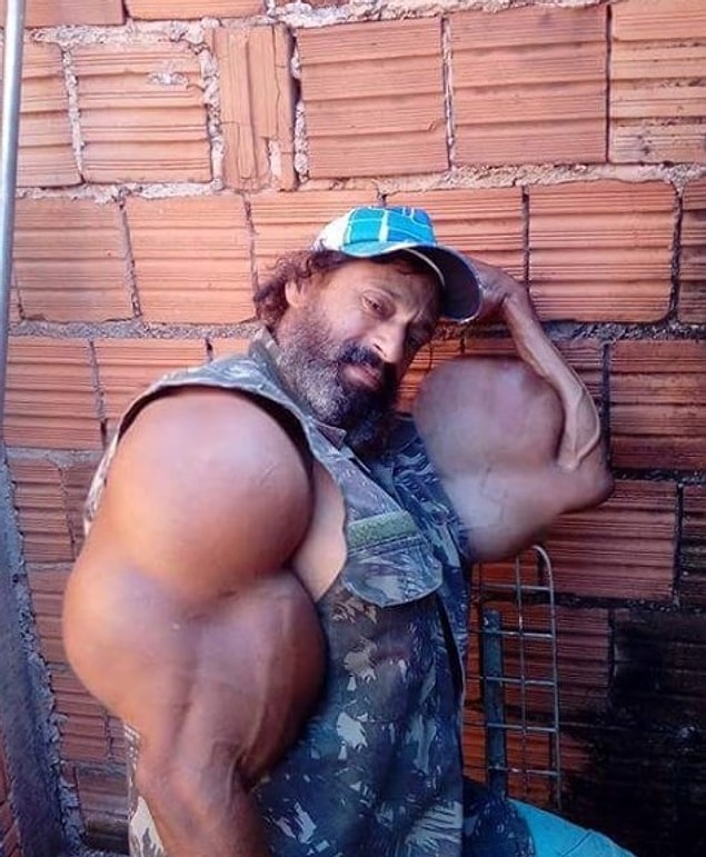 Gittiği spor salonunda birisi, Valdir'e sentol önerdi ve bir süre sonra kas geliştirmek için kullanılan kimyasallara kafayı taktı.