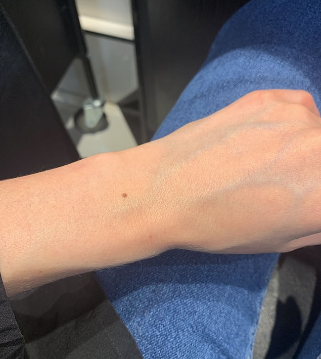 12. Dünya nüfusu oldukça kalabalık, el bileğinde ben olma ihtimali ise % kaç, bunu bilmek çok zor!