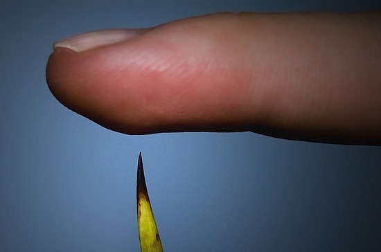 Acı Duyusu Nasıl İşler ve Bizi Nasıl Hayatta Tutar?