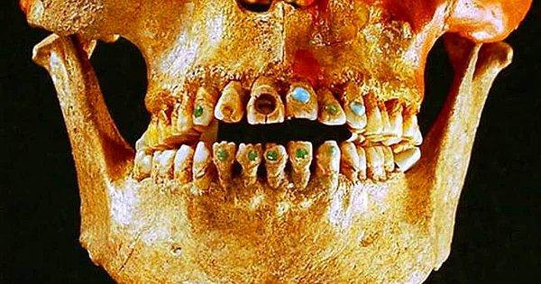 14. Dişçilik M.Ö. 7000 yılından beri yapılmaktadır ve dünyanın en eski işlerinden biridir.