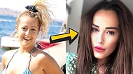 "Sence Estetik Yaptırmışa Benziyor muyum?" Diyen Helin Avşar'ın Geçmişten Günümüze Herkesi Şoka Uğratacak Büyük Değişimi!