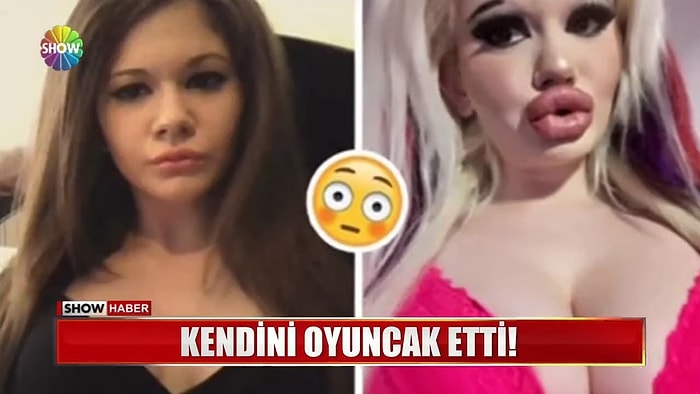 Barbie Bebeğe Benzemek İçin 1 Yılda 15 Ameliyat Olan Kadın: Andrea Ivanova