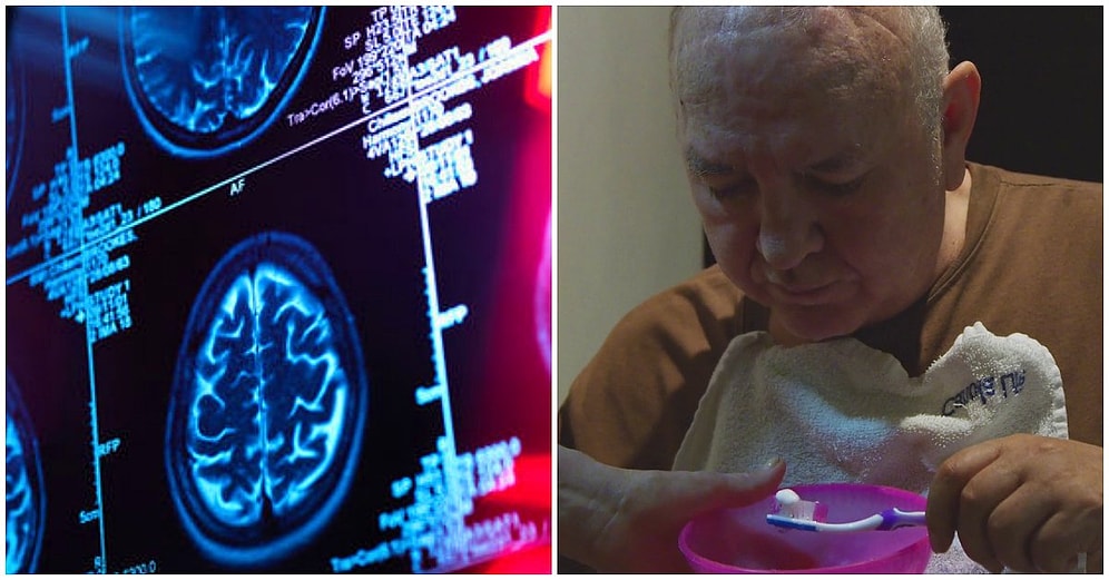 Yalnızca Dişlerinizi Fırçalayarak Alzheimer'a Yakalanma Riskini Azaltabileceğinizi Biliyor muydunuz?