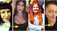 Değişimleriyle 'Senin Yüzüne N'olmuş?' Dedirten Ünlülerin Eski ve Yeni Halleri Sizi Fena Afallatacak