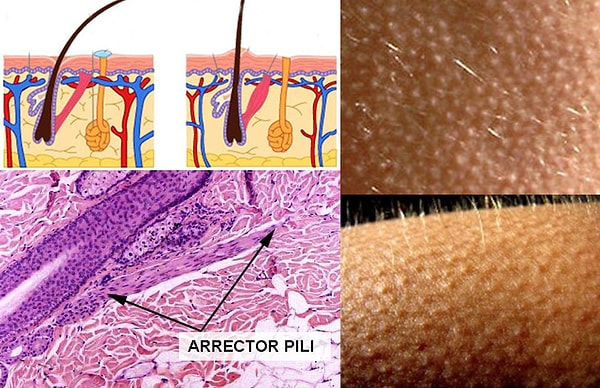 1. Аrrector pili (мышца, поднимающая волосы)