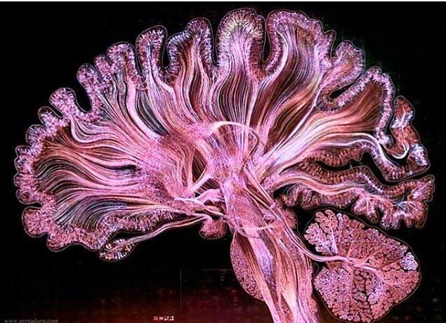4. Traktografi (özel bir MRI yöntemi) beynin farklı bölgelerini birbirine bağlayan sinir yollarını gösterir.