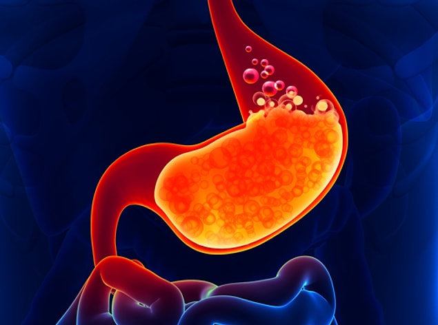1. Gastroözofageal reflü hastalığı