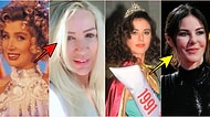 Kırışıklıklara Savaş Açayım Derken Botoksun Ayarını Kaçırıp Bambaşka Birine Dönüşen Ünlüler