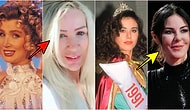 Kırışıklıklara Savaş Açayım Derken Botoksun Ayarını Kaçırıp Bambaşka Birine Dönüşen Ünlüler