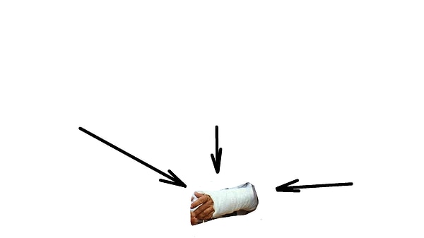 12. Самый дорогой гипс был в фильме...