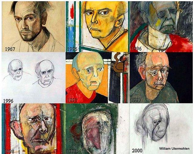 Alzheimer hastası olduğunu öğrendikten sonra beş yıl boyunca aklında kalanlarla kendini resmetmeye devam etti Utermohlen... Hafızası onu yarı yolda bırakmaya başlamışken, o içindeki acıyı elinden geldiğince sanatına yansıtıyordu.