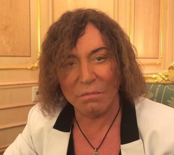 Кажется, певец уже не мог остановиться, и дальнейшие операции все больше превращали его лицо в пугающую неподвижную маску.