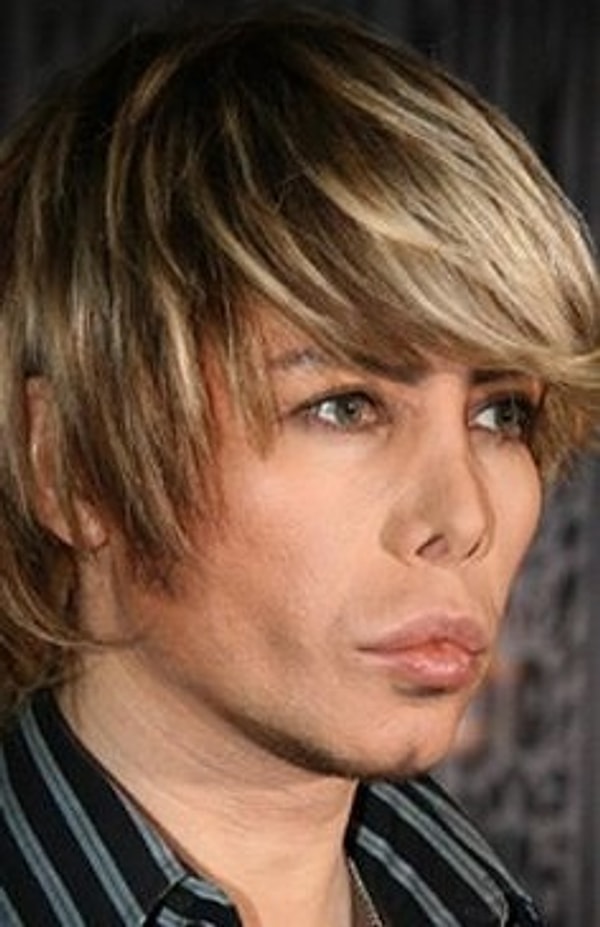 «Нет предела совершенству», — упрямо заявляет Сергей и продолжает ложиться под нож.