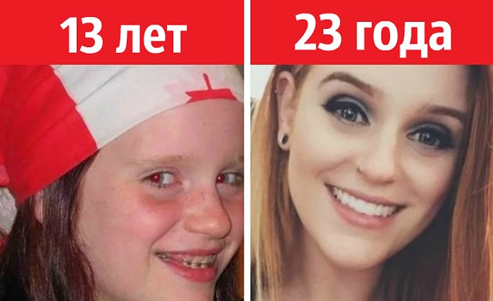 22 «гадких утенка», которые выросли и превратились в прекрасных лебедей