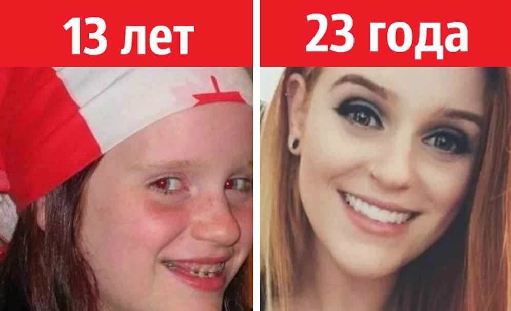 22 «гадких утенка», которые выросли и превратились в прекрасных лебедей