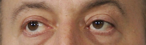 5. А это чьи глаза?